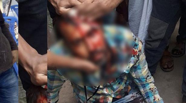 সংবাদ সংগ্রহে গিয়ে হামলার শিকার ৬ সাংবাদিক